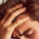 la caspa puede ser un problema intenso con una fácil solucion